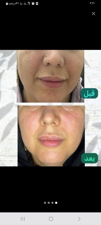 بازاریابی و فروش و آموزش محصولات پوست و مو